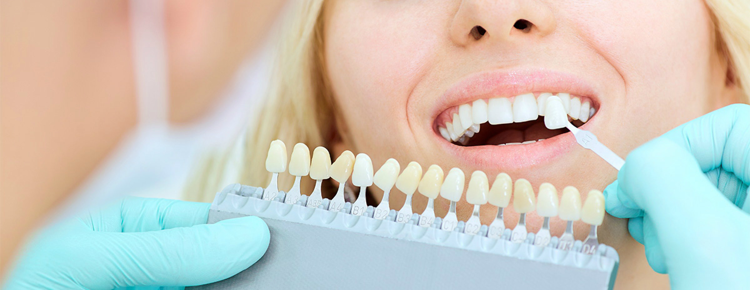 Эстетическая реставрация зубов в нашей стоматологии