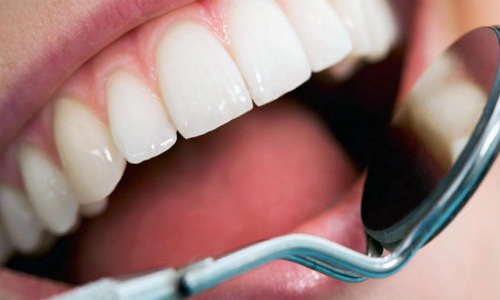 Открыли действенный метод восстановления зубной эмали