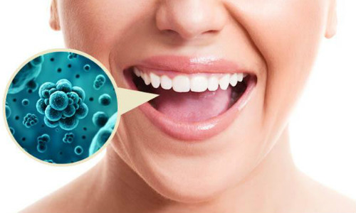 Почему развиваются бактерии в зубном налете?
